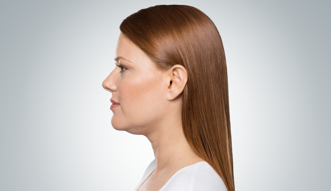 Before Treatment